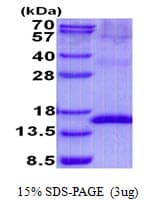 Human UPK2 / UPII / Uroplakin 2 Protein (Recombinant His)