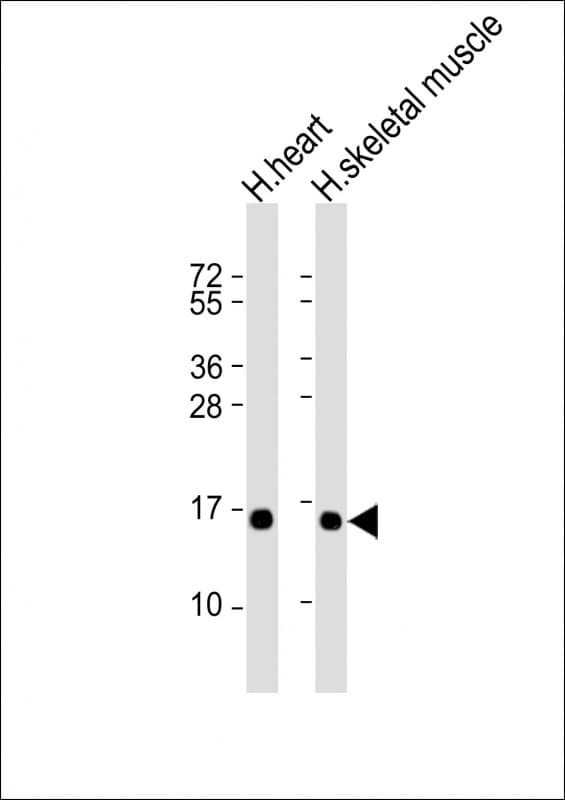 TUSC2 / FUS1 Antibody (clone 1550CT388.74.12)