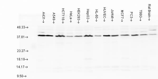 IHC-plus™ AHSA1 / AHA1 Antibody