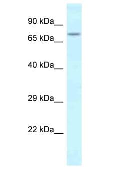 Polyclonal Rabbit anti-Mouse SLITRK1 Antibody (aa556-605, WB)