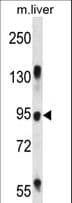Polyclonal Rabbit anti-Human RASAL1 / RASAL Antibody (aa309-337, WB)