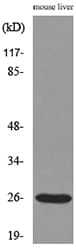 TNF Alpha Antibody