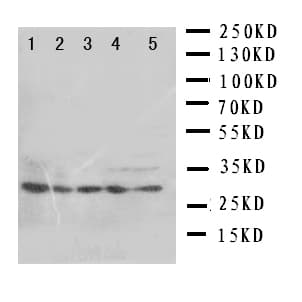 SFN / Stratifin / 14-3-3 Sigma Antibody (aa140-156)