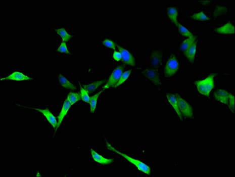RTCB / C22orf28 Antibody
