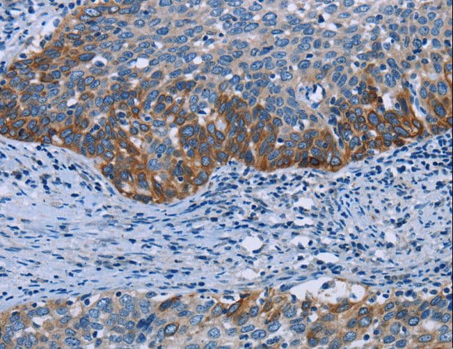 Polyclonal Rabbit anti-Human HOMER1 / Homer 1 Antibody (IHC, WB)