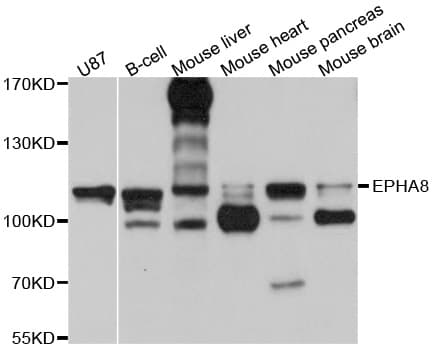 EPHA8 / EPH Receptor A8 Antibody