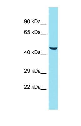 KRT78 / Keratin 78 Antibody (aa149-197)