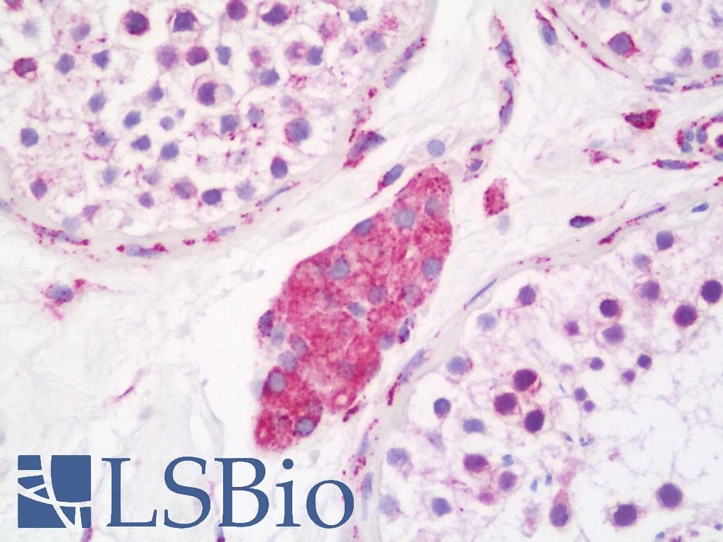 IHC-plus™ CKAP4 Antibody (aa500-550)