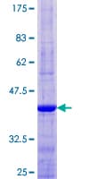 Human AKR1C8P / AKR1CL1 Protein (Recombinant GST)