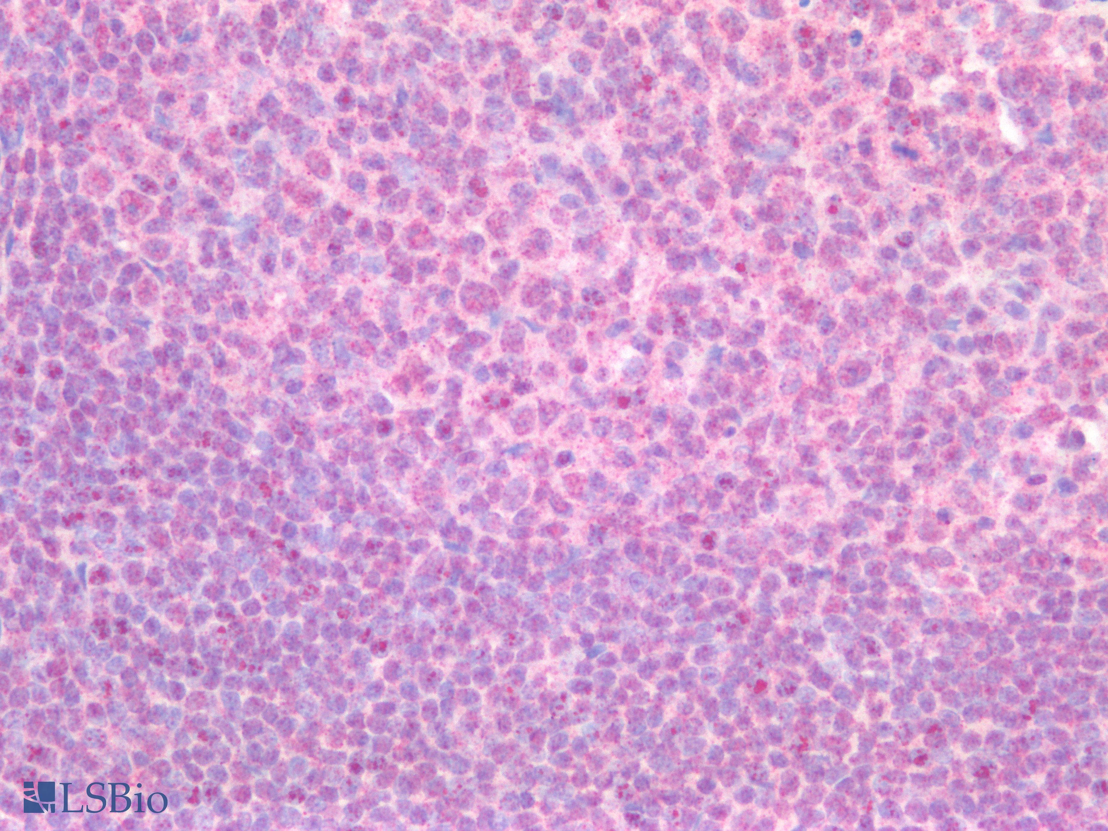 IHC-plus™ ERG Antibody (clone 2G8)