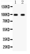 GRIA2 / GLUR2 Antibody (aa25-360)