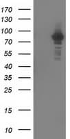 PRKCE / PKC-Epsilon Antibody (clone OTI1G5)
