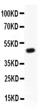 KCNB1 / Kv2.1 Antibody (aa687-858)