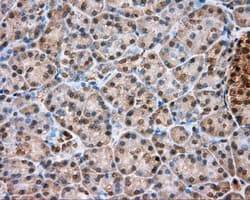 TPMT Antibody (clone OTI4C1)
