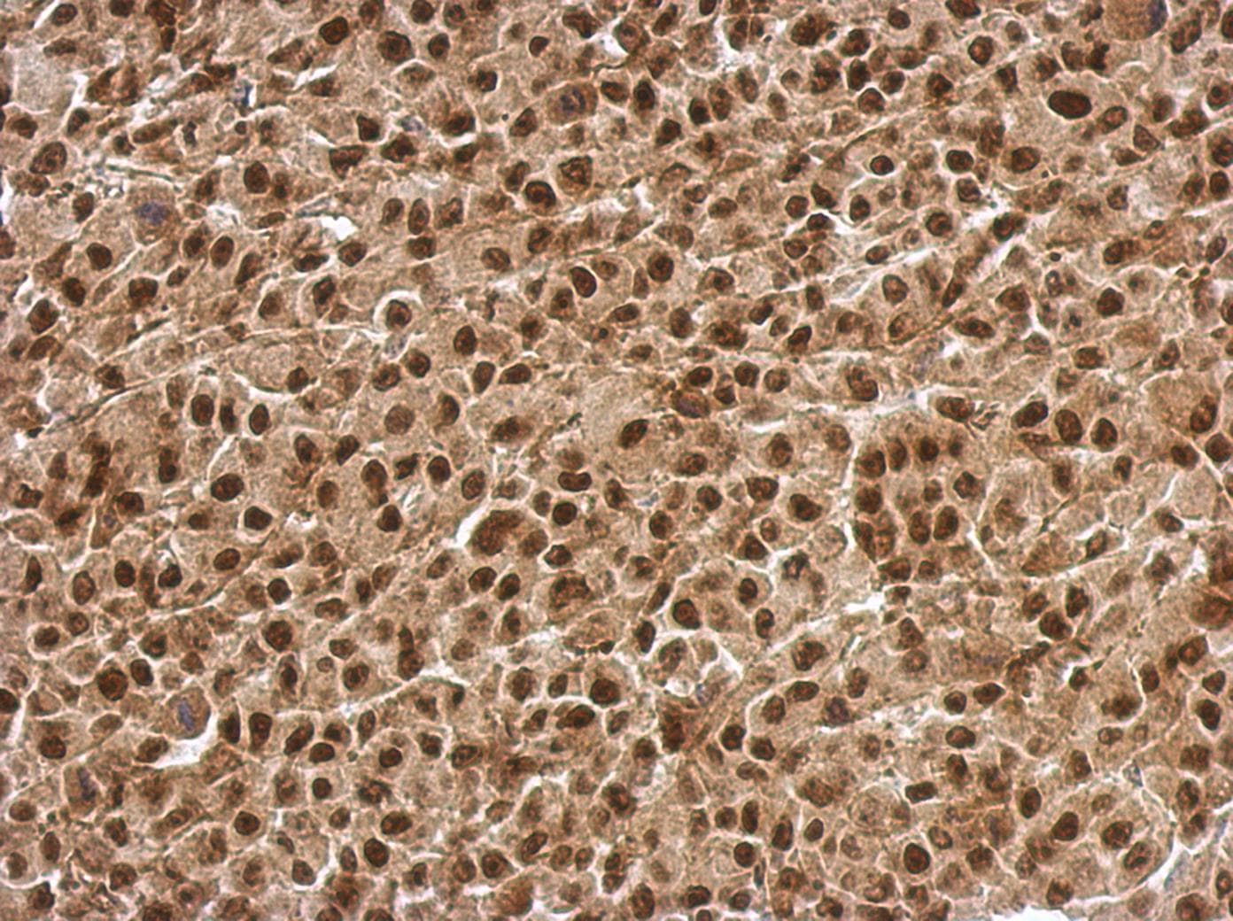 BCL7C Antibody