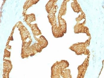 Acidic Cytokeratin Antibody (clone KRTL/1077)