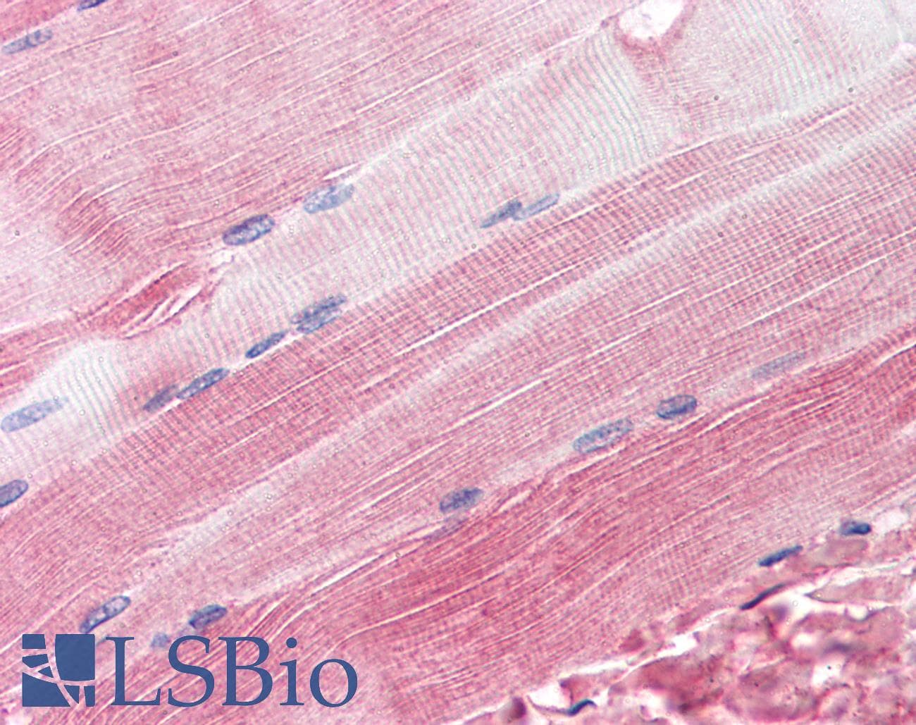 IHC-plus™ RAPSN Antibody (aa395-412)