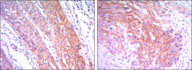 HK2 / Hexokinase 2 Antibody (clone 3D3)