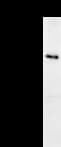 PPP1R13L / iASPP Antibody (clone 2808C5a)