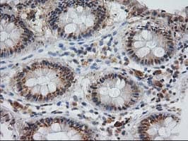 Monoclonal Mouse anti-Human MGLL / Monoacylglycerol Lipase Antibody (clone OTI1H1, IHC, IF, WB)