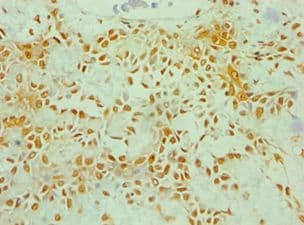 ZNF346 Antibody (aa1-294)
