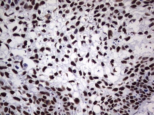 Monoclonal Mouse anti-Human PPP1R8 / Rnase E Antibody (clone OTI4E5, aa1-225, IHC, WB)
