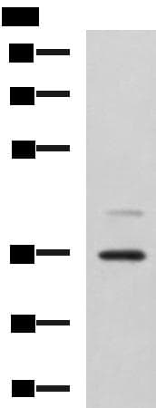 UBLCP1 Antibody