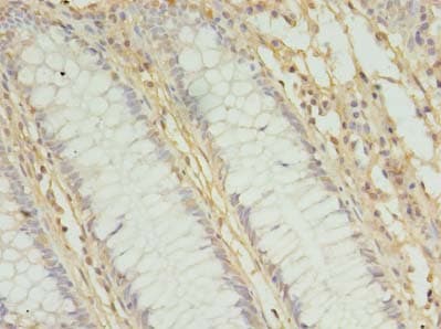 MRPL3 Antibody