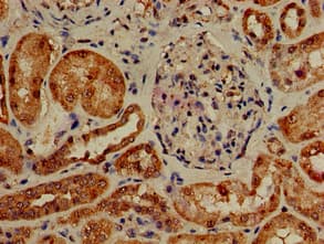 Polyclonal Rabbit anti-Human PIK3R4 Antibody (IHC, IF)