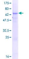 Human TTC23L / FLJ25439 Protein (Recombinant GST)