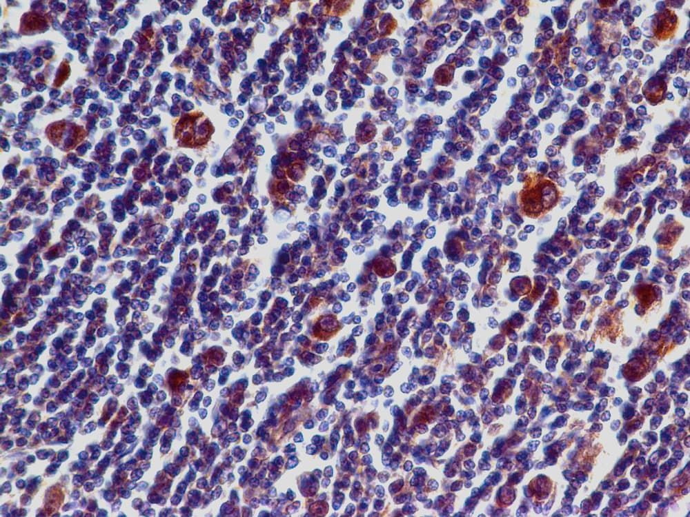 CD274 / B7-H1 / PD-L1 Antibody