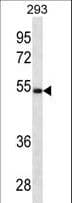 IHC-plus™ LGMN / Legumain Antibody (aa83-112)