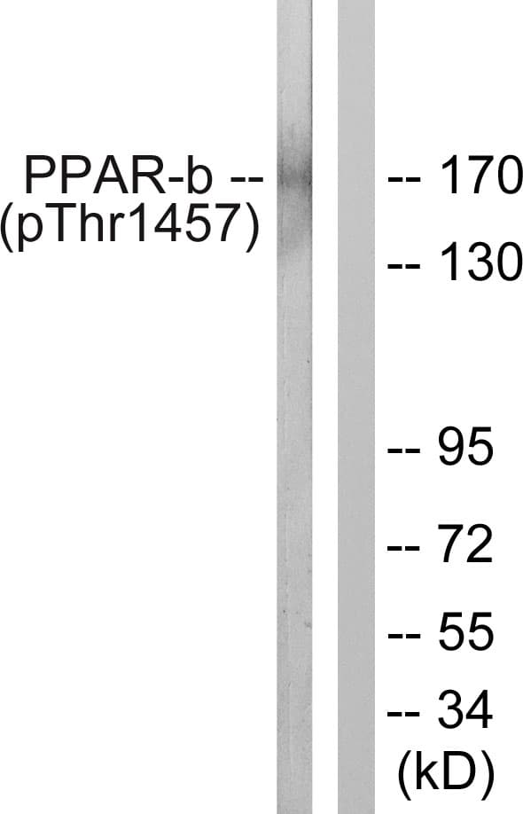 MED1 / TRAP220 Antibody (phospho-Thr1457)