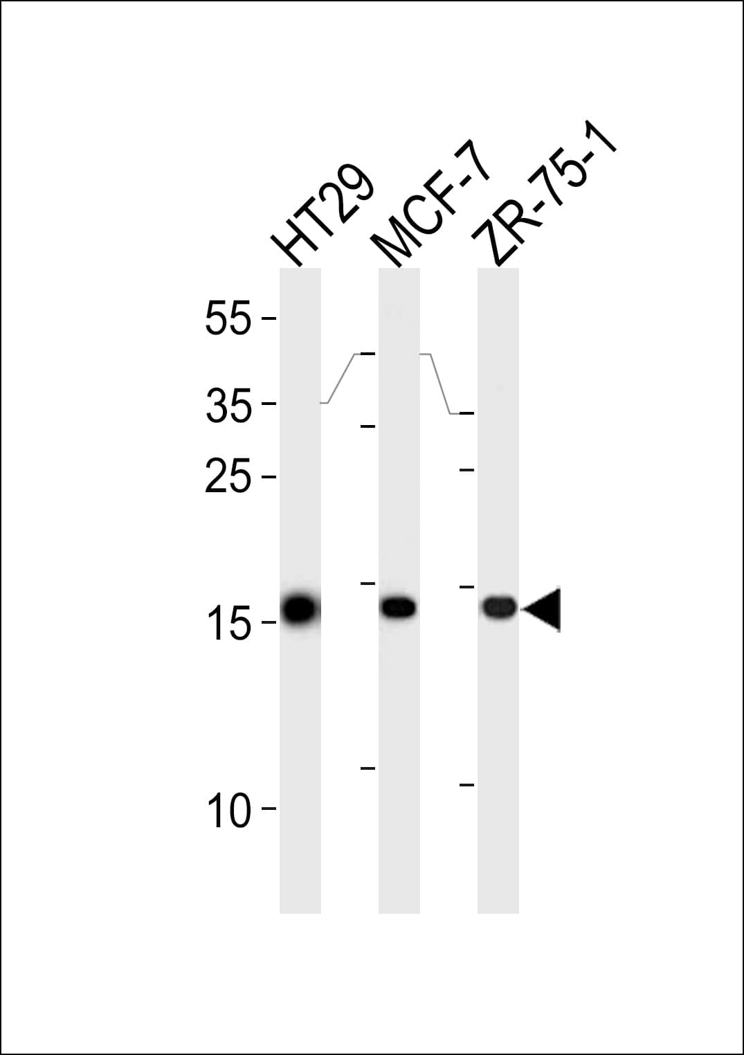 IHC-plus™ AGR2 Antibody (aa95-124)