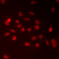 Polyclonal Rabbit anti-Human RAD9A / RAD9 Antibody (IHC, IF, WB)