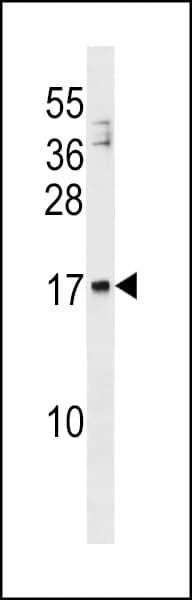 Polyclonal Rabbit anti-Human MANF / ARMET Antibody (aa23-51, WB)