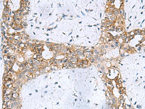 RPL10A Antibody
