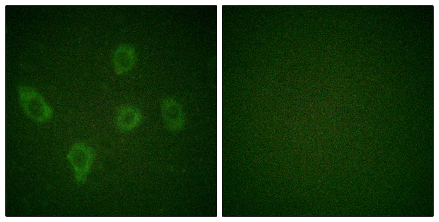 Polyclonal Rabbit anti-Human CASP9 / Caspase 9 Antibody (aa91-140, IHC, IF, WB)