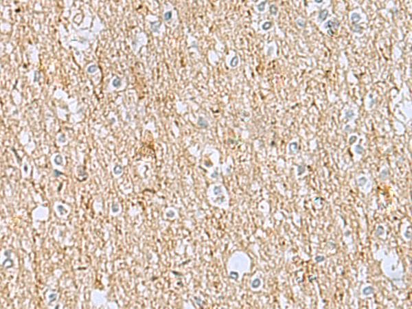 Polyclonal Rabbit anti-Human LRRC49 Antibody (IHC)