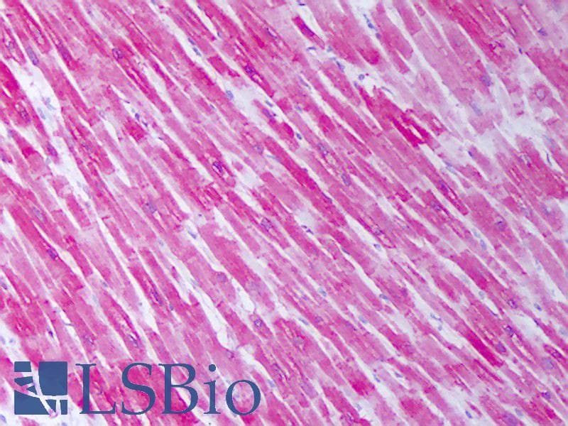 IHC-plus™ HSPB1 / HSP27 Antibody (clone 5D12-A12)
