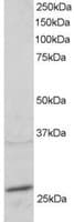 Polyclonal Goat anti-Human RAB11A Antibody (aa204-216, WB)