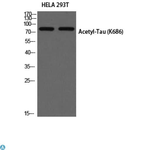 MAPT / Tau Antibody