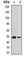 CCM2 / Malcavernin Antibody