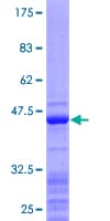 Human RPS15 / Ribosomal Protein S15 (Recombinant GST)