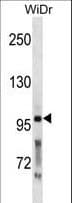 PC5 / PCSK5 Antibody (aa95-124)