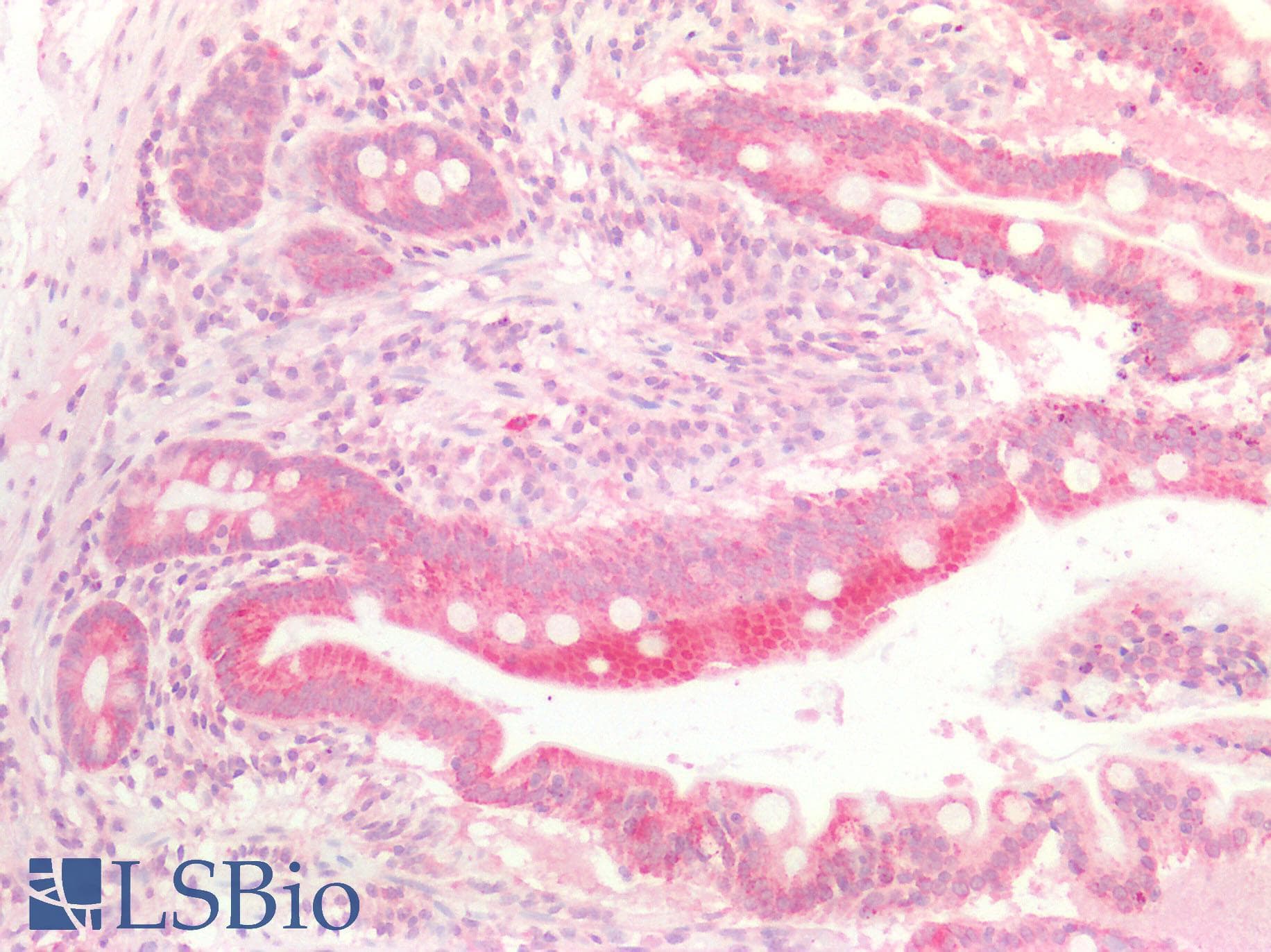 IHC-plus™ p16INK4a / CDKN2A Antibody