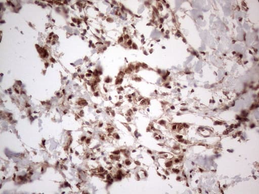 IRS1 Antibody (aa1-280, clone OTI3G10)