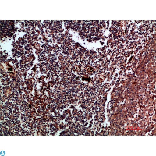 Polyclonal Rabbit anti-Human CDK6 Antibody (IHC, WB)