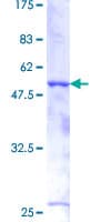 Human BCAS2 Protein (Recombinant GST)