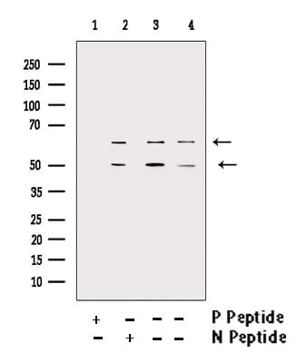 Polyclonal Rabbit anti-Human CaMKII Beta+Gamma+Delta Antibody (phospho-Thr287, IHC, WB)